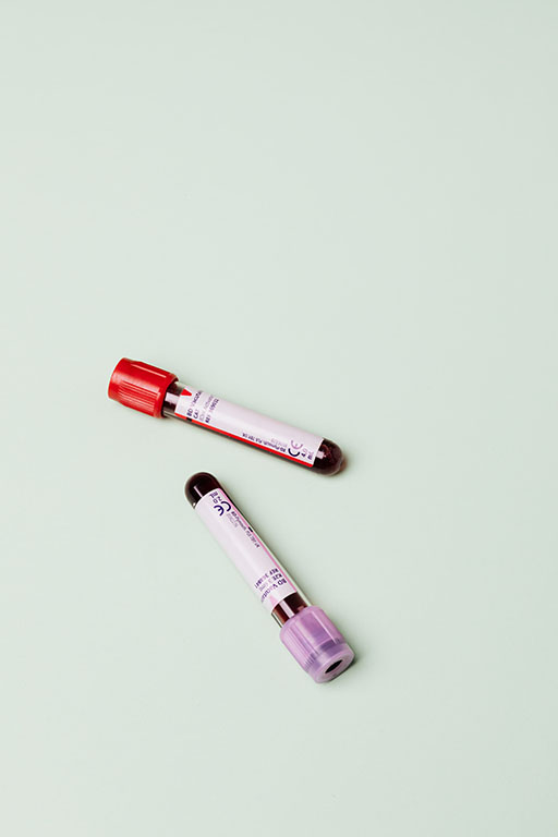 two ampoule containing blood