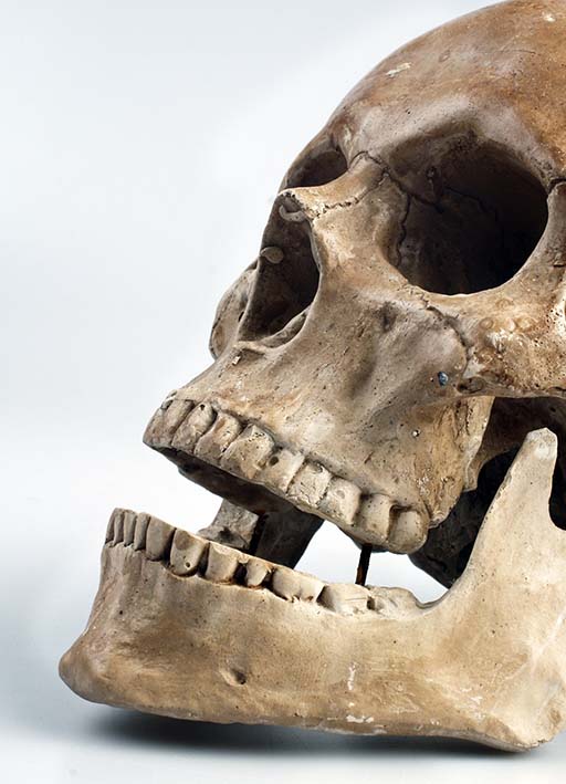 Closeup of a human skull. Are those herbivorous teeth?